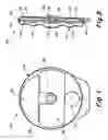 Fig. 02 - Medication infusion device using negatively biased ambient pressure medication chamber
