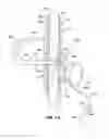 Fig. 02 - Abdominally implanted stimulator and method