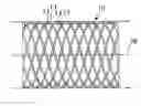 Fig. 01 - Drug release coated stent