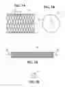 Fig. 02 - Drug release coated stent