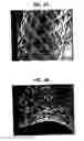 Fig. 04 - Drug release coated stent