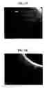 Fig. 07 - Drug release coated stent