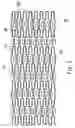 Fig. 02 - Medical implant with average surface charge density