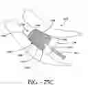 Fig. 35 - Interspinous process implant and method of implantation