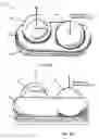 Fig. 03 - Dynamic spinal implant or joint replacement