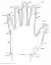 Fig. 01 - Self-examination device