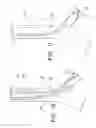 Fig. 06 - Endobronchial blocking device having a replaceable snare