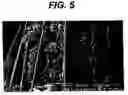 Fig. 06 - Method of preparing a packaged antimicrobial medical device