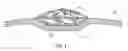 Fig. 07 - Beverage bottle with sidewall detail
