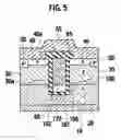 Fig. 06 - Trench MIS device and method for manufacturing trench MIS device