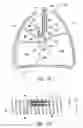 Fig. 09 - Systems and methods for treating a lung of a patient using guided radiation therapy or surgery