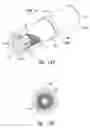 Fig. 14 - Systems and methods for treating a lung of a patient using guided radiation therapy or surgery