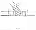 Fig. 02 - Periadventitial delivery device