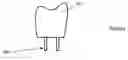 Fig. 08 - Method and apparatus for manufacturing and constructing a physical dental arch model