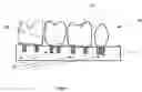 Fig. 09 - Method and apparatus for manufacturing and constructing a physical dental arch model