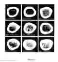 Fig. 07 - Method for fostering bone formation and preservation