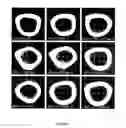 Fig. 08 - Method for fostering bone formation and preservation