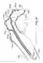 Fig. 52 - Movement facilitation device