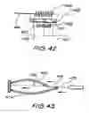 Fig. 53 - Movement facilitation device