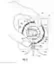 Fig. 06 - Self-suturing anchor device for a catheter