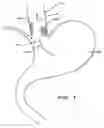 Fig. 02 - Methods and systems for determining physiologic characteristics for treatment of the esophagus