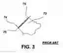 Fig. 06 - Contoured reamer teeth and method of manufacture