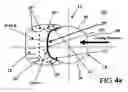 Fig. 07 - Contoured reamer teeth and method of manufacture