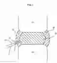 Fig. 03 - Methods for explantation of intervertebral disc implants