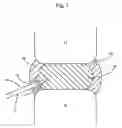 Fig. 04 - Methods for explantation of intervertebral disc implants