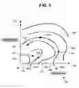 Fig. 07 - System and method for performing arthroplasty of a joint and tracking a plumb line plane
