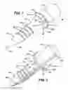 Fig. 02 - Method of delivering therapeutic implant