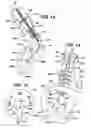 Fig. 06 - Method of delivering therapeutic implant