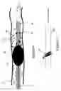 Fig. 06 - Fluid occluding devices and methods