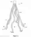 Fig. 02 - Retrievable vena cava filter