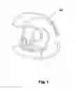 Fig. 02 - Ebolic apparatus and methods for tumor vasculture system obstruction