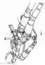 Fig. 07 - Arterial compression device and method