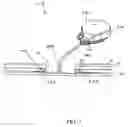 Fig. 08 - Wound closure product
