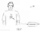Fig. 07 - System and method for filtering neural stimulation