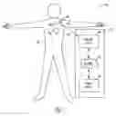 Fig. 02 - Methods and apparatuses for arrhythmia detection and classification using wireless ECG