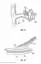 Fig. 02 - Peripheral nerve stimulation to treat auditory dysfunction