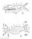 Fig. 02 - Devices, systems, and methods for prosthesis delivery and implantation, including the use of a fastener tool