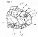 Fig. 02 - Titanium incudo-stapedial joint prosthesis