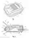 Fig. 02 - Buckle bumper