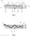 Fig. 02 - Forming fabrics