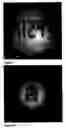 Fig. 06 - Encoding of microcarriers