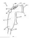 Fig. 02 - Cleaning spray nozzle