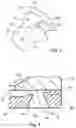 Fig. 04 - Low pressure fuel injector nozzle
