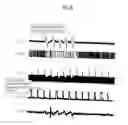 Fig. 09 - Header mask signal generating track jump method for a recording medium