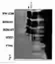 Fig. 07 - Novel use of adenoviruses and nucleic acids coding therefor