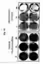 Fig. 11 - Novel use of adenoviruses and nucleic acids coding therefor